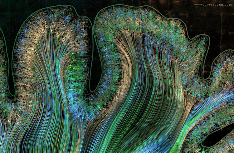 Beyin Taramasından Sanat Yaratan Bilim İnsanları 8. Fotoğraf